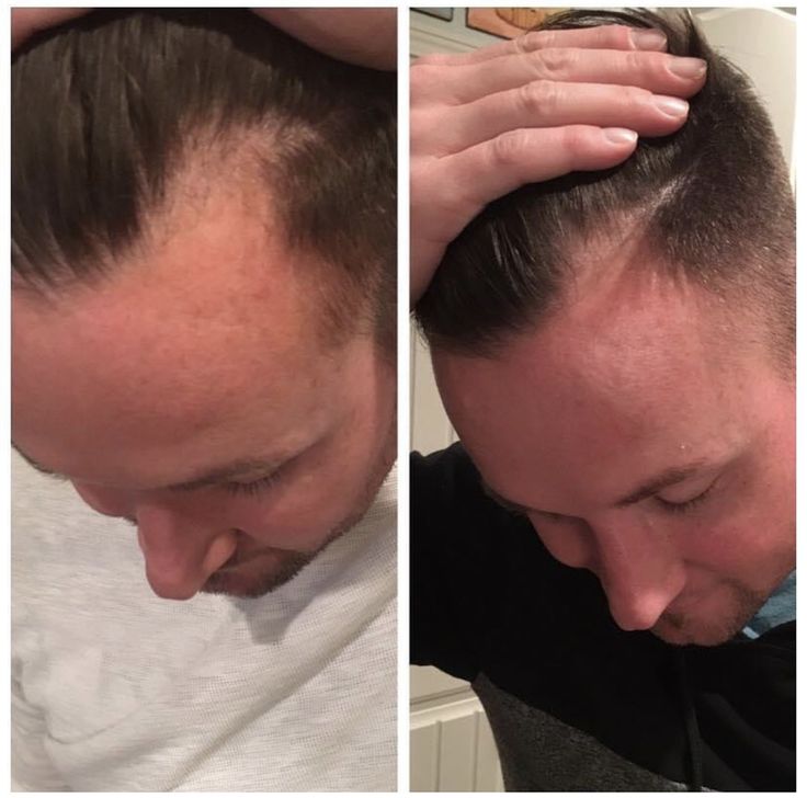Before & after