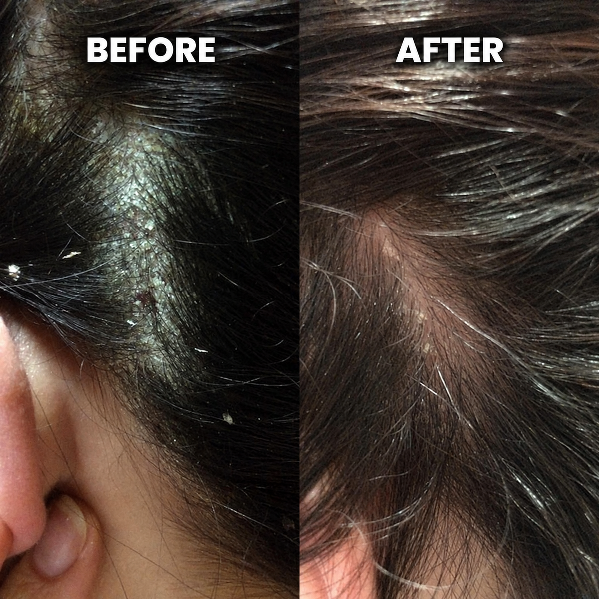 FLAKERA Tea Tree + Mint Scalp Scrub