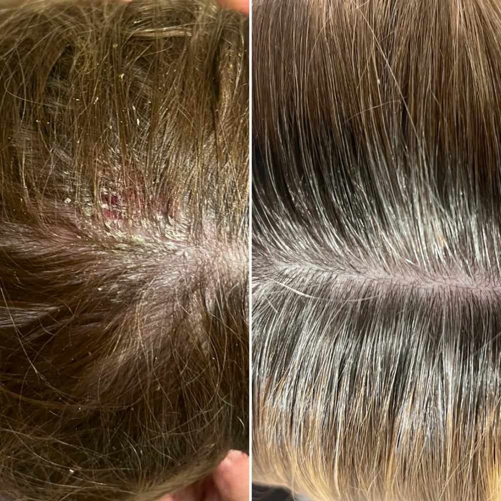 Before & after